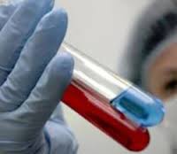 Беларусь временно ограничивает поставки мяса птицы из Германии из-за вируса H5N1